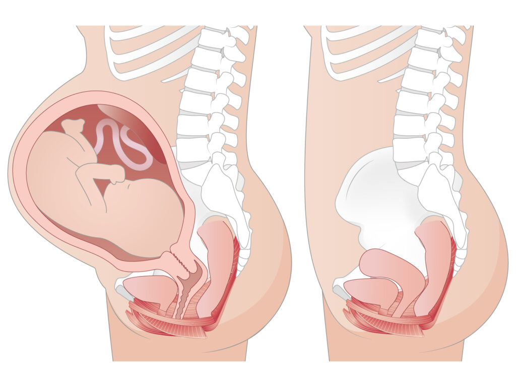 妊娠や出産による腹筋や骨盤底筋のケア、術後の腹筋のケア